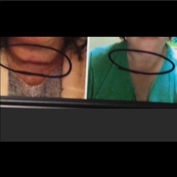 ❤️🩹BEST IN BEAUTY PICK ❤️Miracle Healing ❤️🩹 Balm—SUNDAY APPRECIATION SALE!$ - Picture 5 of 9